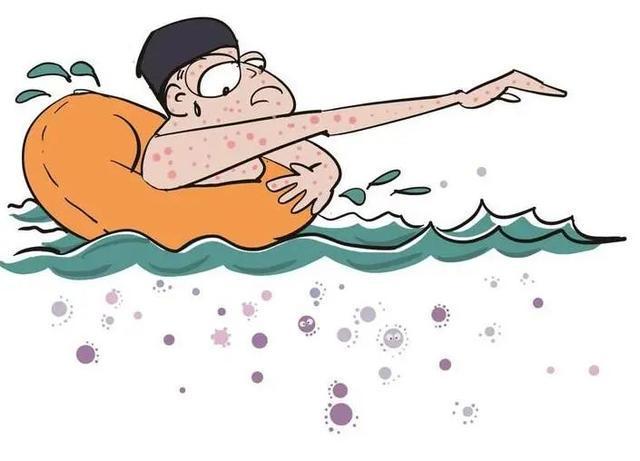 1774229207869698.jpeg 游泳池細菌2.jpeg